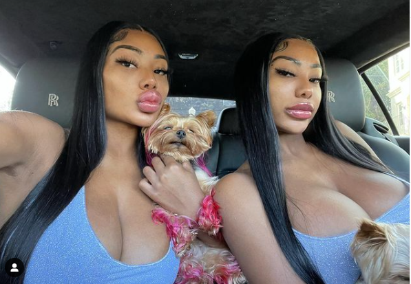CLERMONT TWINS BEFORE SURGERY