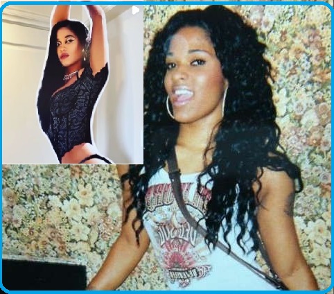 Joseline Hernandez Before Surgery