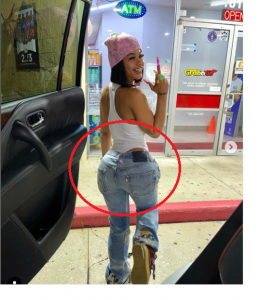 India Love BBL! India Love Before Surgery!! - FameLord