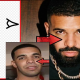 Drake Nose Job