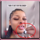 How Did Chrisean Rock Lose Her Tooth