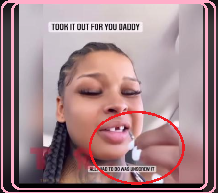 How Did Chrisean Rock Lose Her Tooth