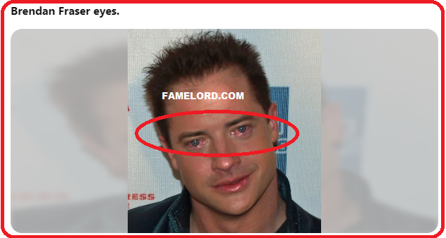 Brendan Fraser RED Eyes